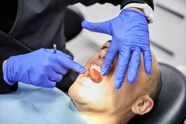 Professional Emergency Dentist in MD